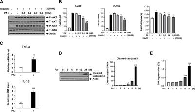 Protective effect of empagliflozin against palmitate-induced lipotoxicity through AMPK in H9c2 cells